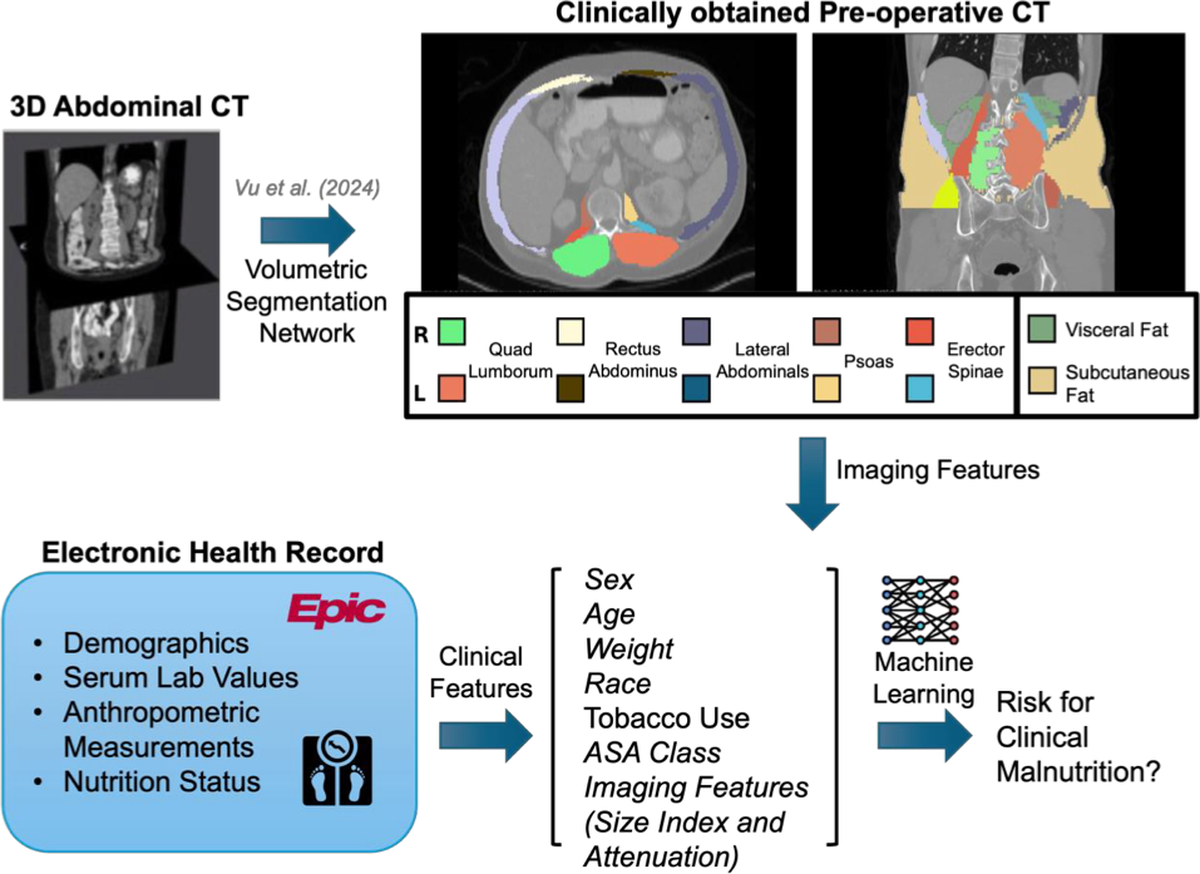 Pipeline combining automated CT body composition segmentation with electronic health record features to predict malnutrition risk