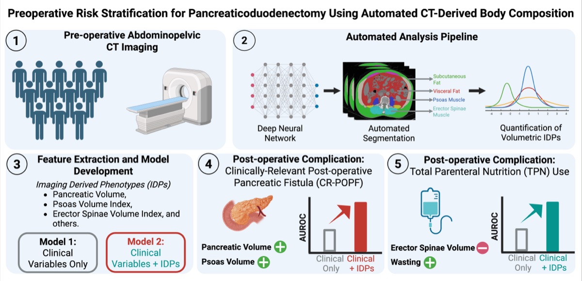 Graphical abstract: automated CT body composition pipeline for preoperative risk stratification in pancreaticoduodenectomy